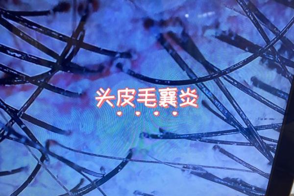 2026年5月理发头皮微生物组护理与吉日:科学护发健康管理 2026年5月理发头皮微生物组护理与吉日:科学护发健康管理