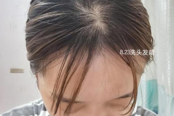 梦见头发被剪短了是什么意思(孕妇梦见头发被剪短了是什么意思)