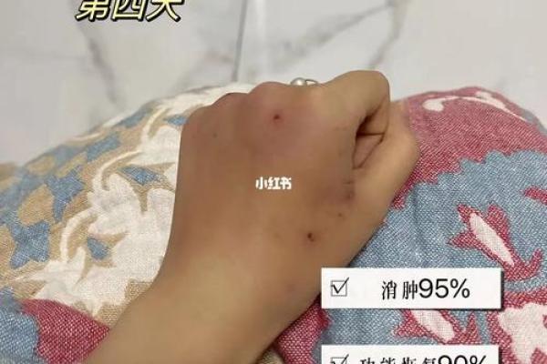 梦见被猫咬了是什么意思-梦见被猫咬了是什么意思没出血
