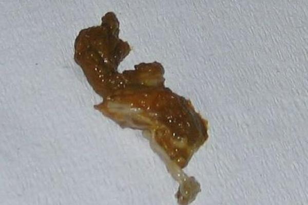 梦到拉屎是什么征兆 女性(梦到拉屎是什么征兆 女性用手抓屎)