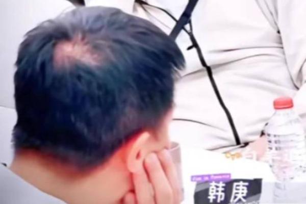 梦见自己头发秃了一大片是什么意思(女人梦见头发掉了秃了一大片)